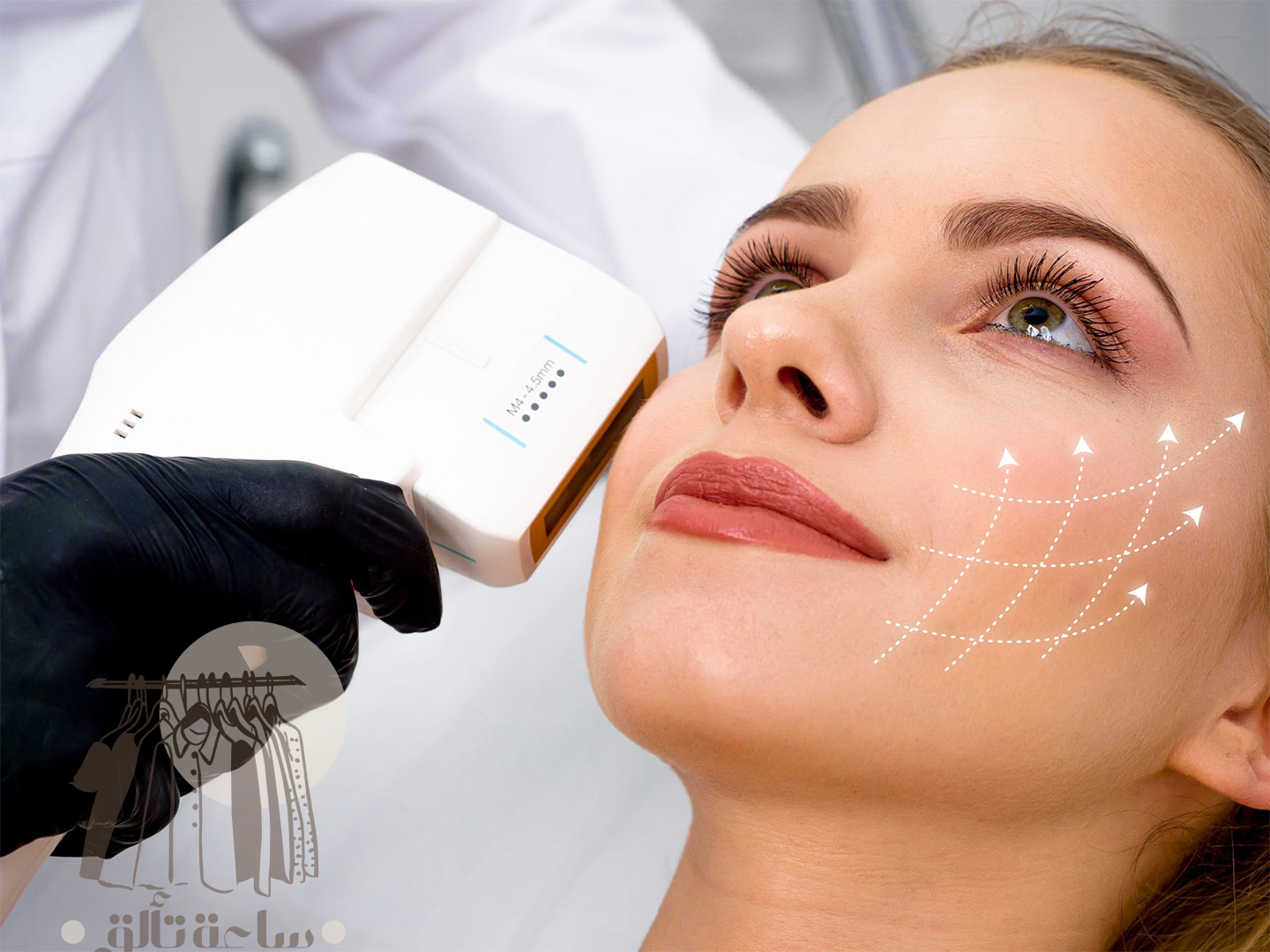 تشقير شعر الوجه بالليزر