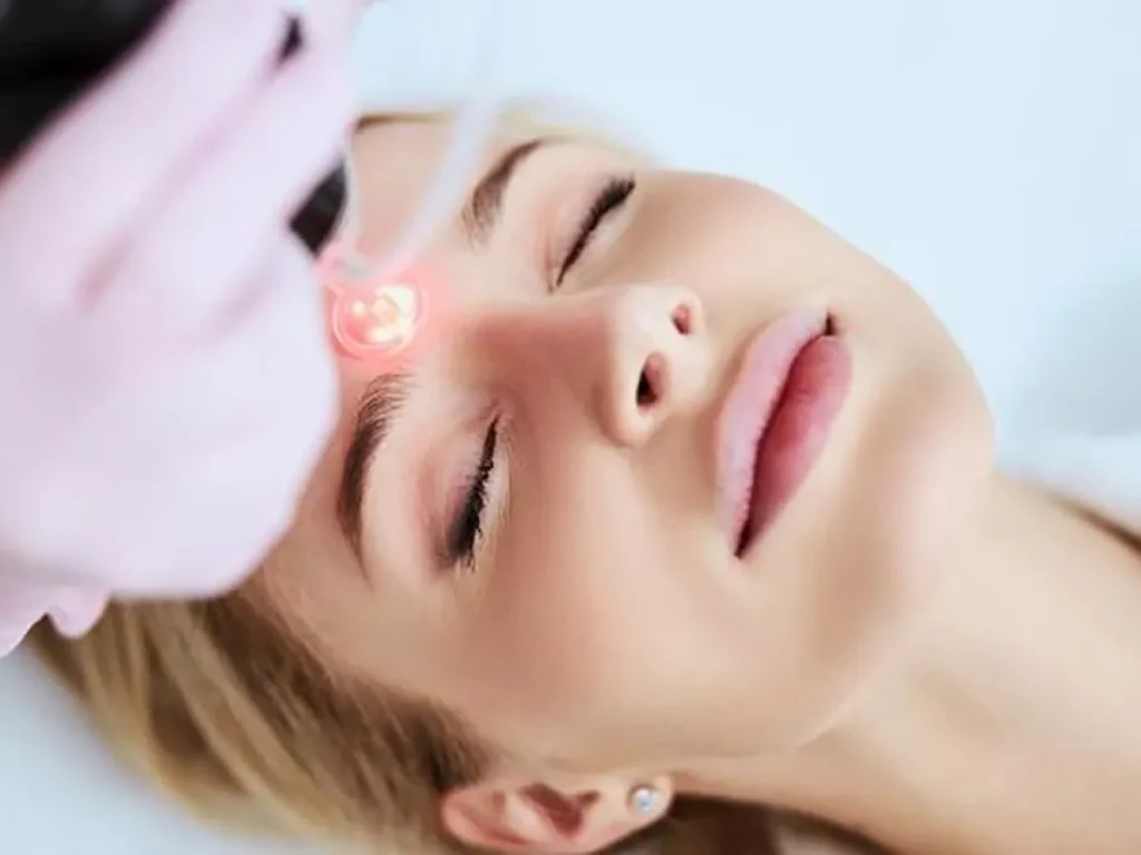 تجارب إزالة شعر الوجه بالليزر