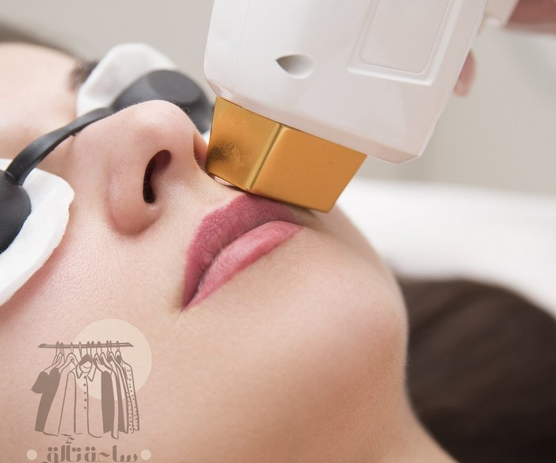 تجربتي مع توريد الشفايف بالليزر