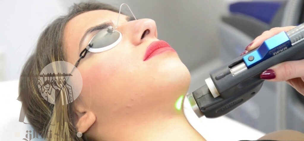 جهاز ديكا ليزر