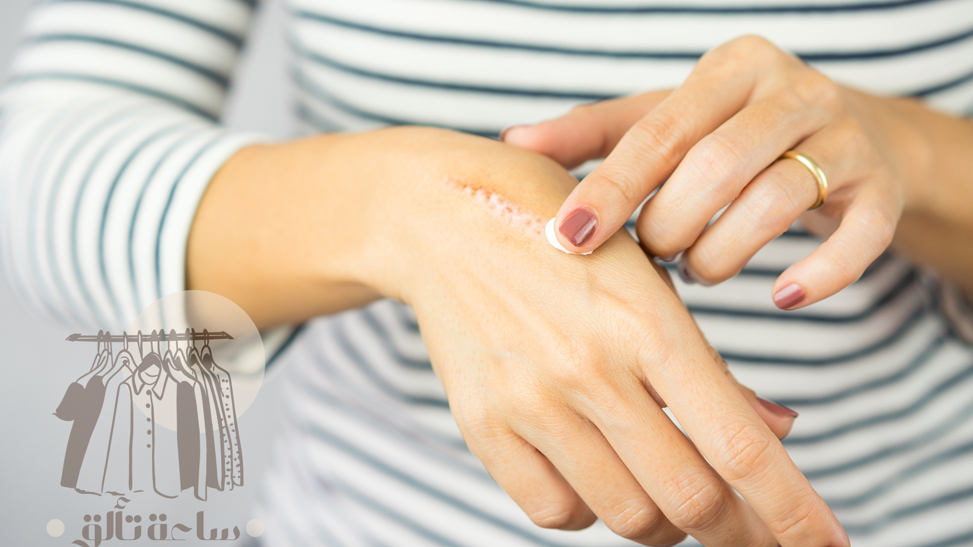 كريمات تساعد على التئام الجروح 1 كريمات تساعد على التئام الجروح