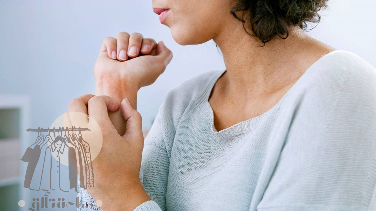 أفضل كريم لعلاج الإكزيما نهائياً 2 أفضل كريم لعلاج الإكزيما نهائياً