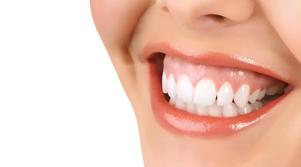 أسعار الابتسامة اللثوية