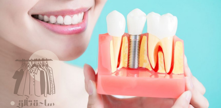 تجربتي مع زراعة الاسنان