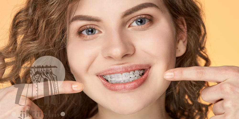 دعامات الأسنان الأنواع والأسعار وطريقة التركيب