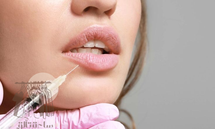 كيف تتخلصين من فيلر الشفايف في المنزل؟ طرق طبيعية آمنة