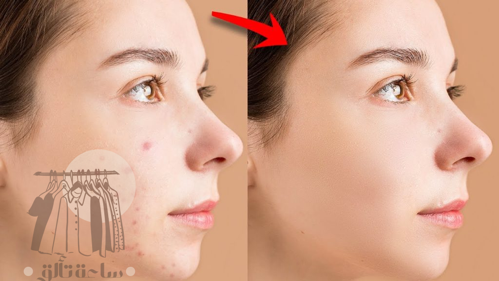 سر مكياج النجمات.. كيف تخفين الحبوب نهائياً بـ 4 خطوات
